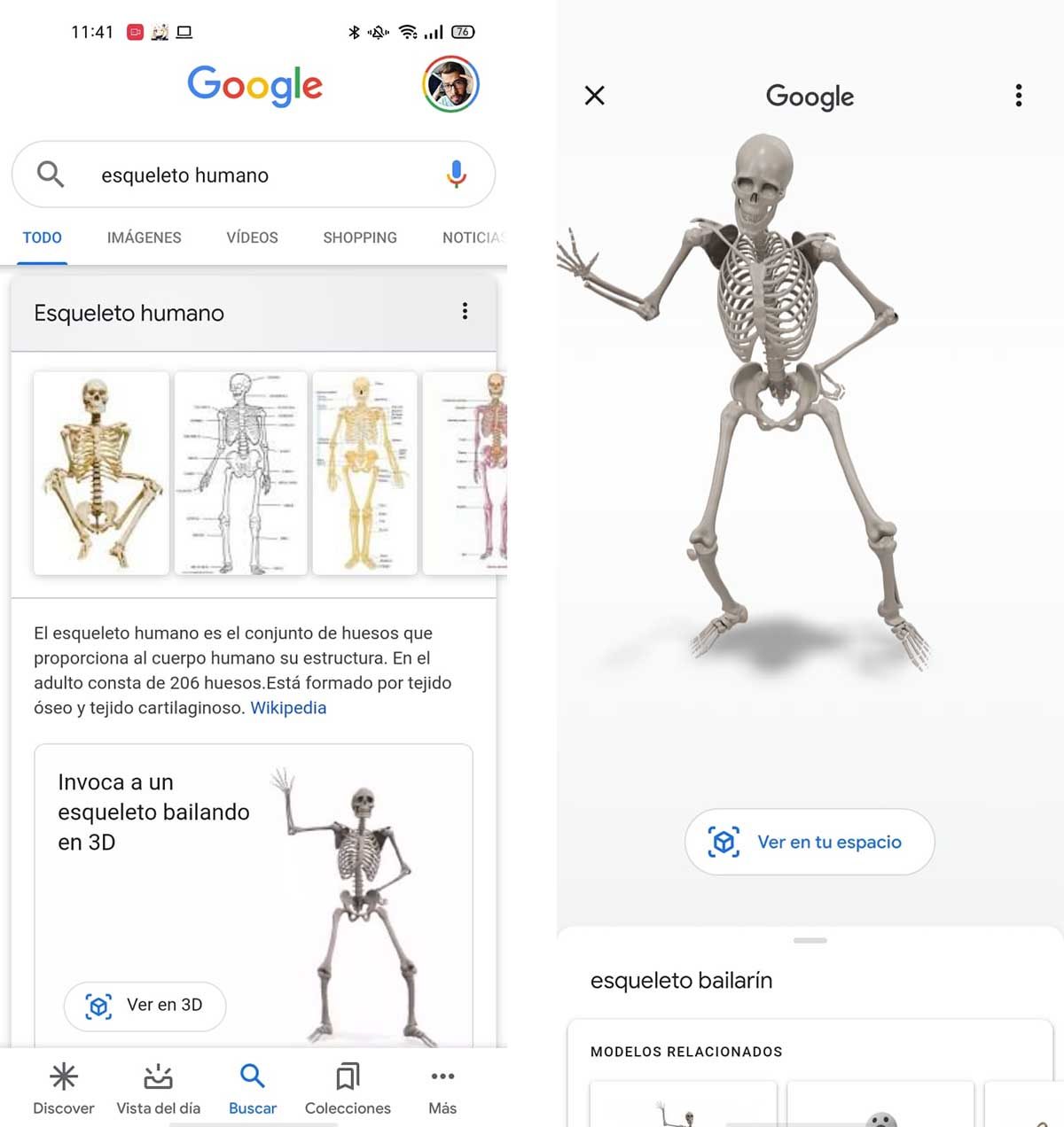 esqueleto 3D